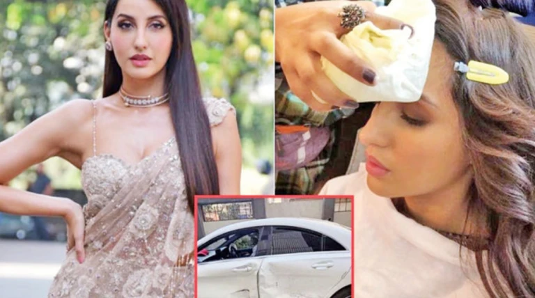 દારૂ પીને કાર ચલાવતાં ડ્રાઈવરની ટક્કરથી નોરા ફતેહીના માથામાં ઈજા, સારવાર બાદ પણ કાર્યક્રમમાં હાજર