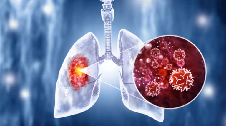 2040 સુધીમાં ભારતમાં કેન્સરના દર્દીઓ વધીને 20 લાખ થવાની ચેતવણી, વૈશ્વિક સ્તરે પણ ચિંતાજનક સ્થિતિ